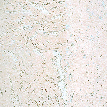 Пробковое настенное покрытие Corkart Classic PW3 386c WS-3.0